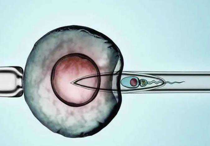 佛山供卵包生,试管婴儿胚胎发育照片-做b超医生从哪判断性别_深圳哪些医院可