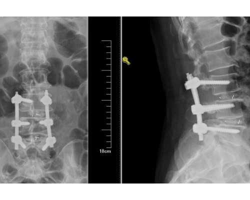 佛山全包代孕套餐,北京第三代试管成功率多高,北京三代试管医院哪些_上海供